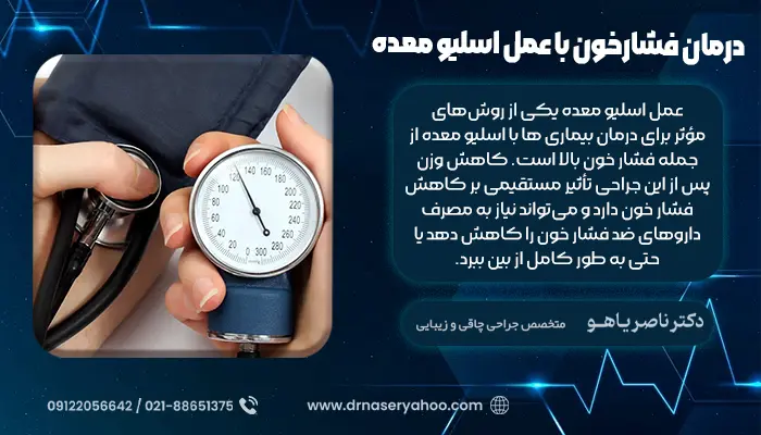 درمان فشارخون با عمل اسلیو معده