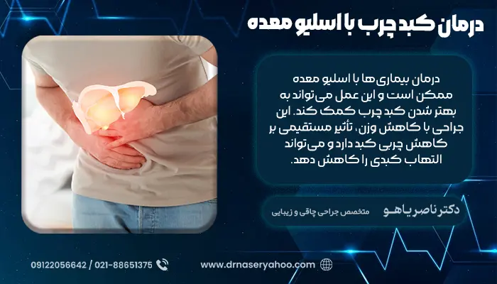 درمان کبد چرب با اسلیو معده