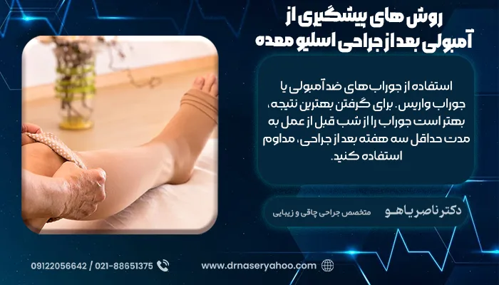 روش‌ های پیشگیری از آمبولی بعد از جراحی اسلیو معده