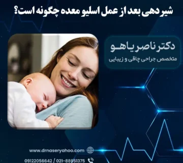 شیردهی بعد از اسلیو معده چگونه است؟