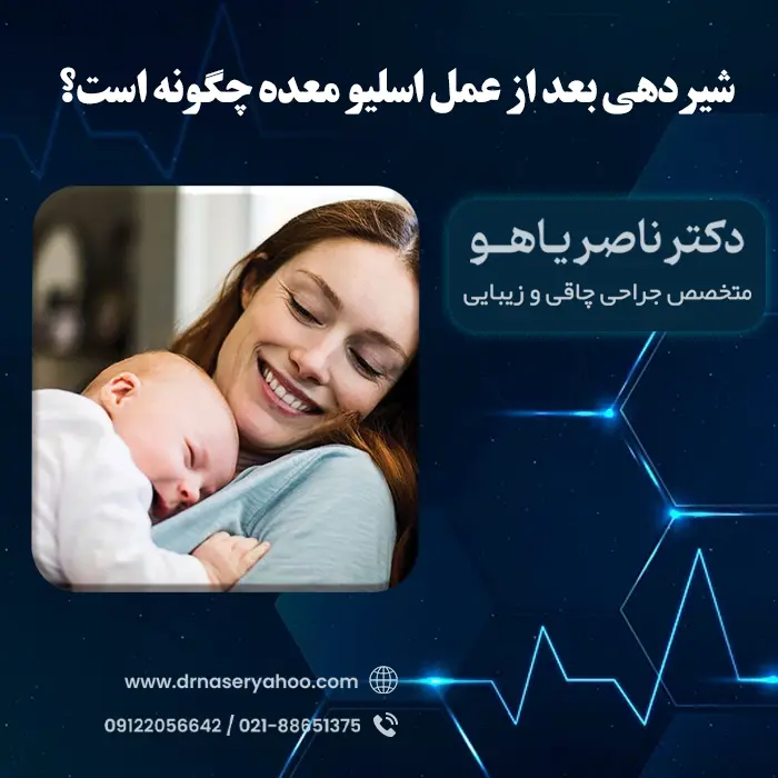 شیردهی بعد از اسلیو معده چگونه است؟