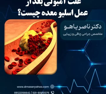 علائم آمبولی بعد از عمل اسلیو معده چیست؟