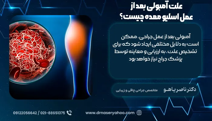 علت آمبولی بعد از عمل اسلیو معده چیست؟