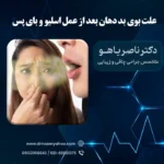 علت بوی بد دهان بعد از اسلیو معده