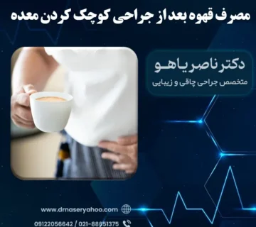 خوردن قهوه بعد از عمل جراحی اسلیو معده
