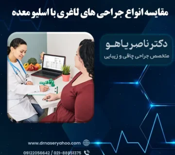 مقایسه جراحی های لاغری با اسلیو معده