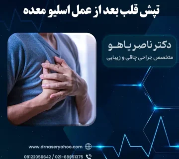 تپش قلب پس از عمل اسلیو معده