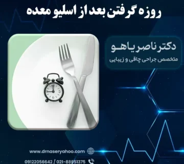 روزه گرفتن بعد از اسلیو معده