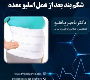 چگونگی پوشیدن گن بعد از عمل اسلیو