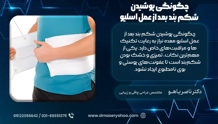 چگونگی پوشیدن شکم بند بعد از عمل اسلیو