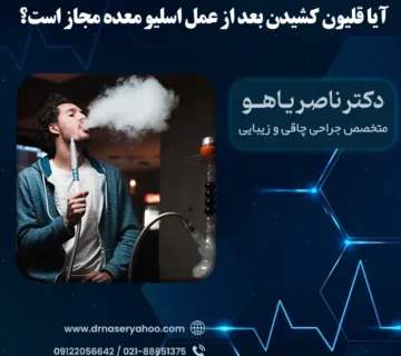 آیا قلیون کشیدن بعد از عمل اسلیو معده مجاز است؟
