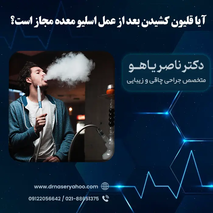آیا قلیون کشیدن بعد از عمل اسلیو معده مجاز است؟