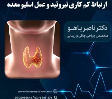 ارتباط کم کاری تیروئید و عمل اسلیو معده