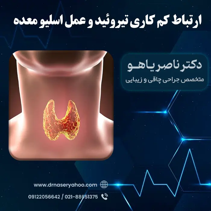 ارتباط کم کاری تیروئید و عمل اسلیو معده