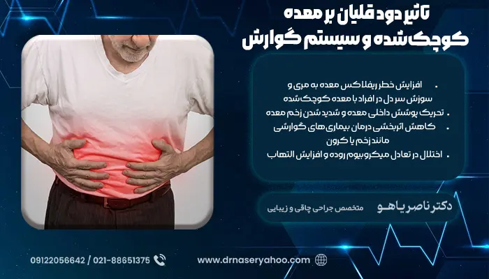 تاثیر دود قلیان بر معده کوچک‌شده و سیستم گوارش