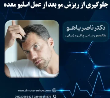 جلوگیری از ریزش مو بعد از عمل اسلیو معده