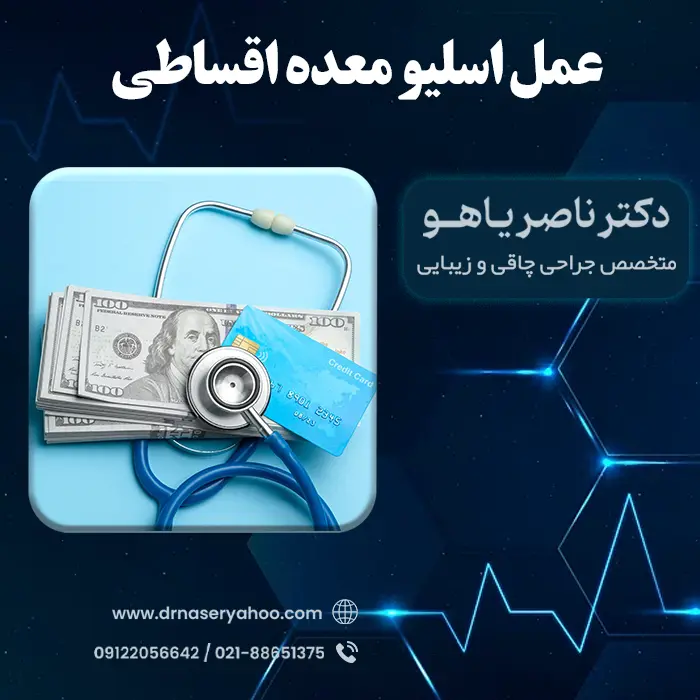 عمل اسلیو معده اقساطی
