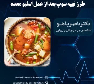 طرز تهیه سوپ بعد از عمل اسلیو معده