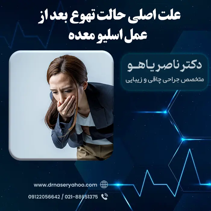 علت اصلی حالت تهوع بعد از عمل اسلیو معده