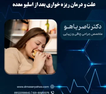 علت و درمان ریزه خواری بعد از اسلیو معده