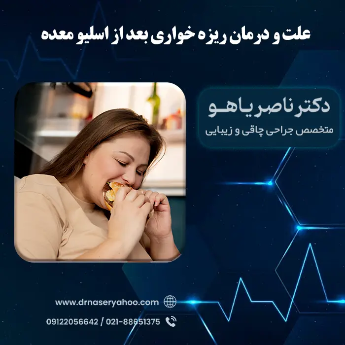 علت و درمان ریزه خواری بعد از اسلیو معده