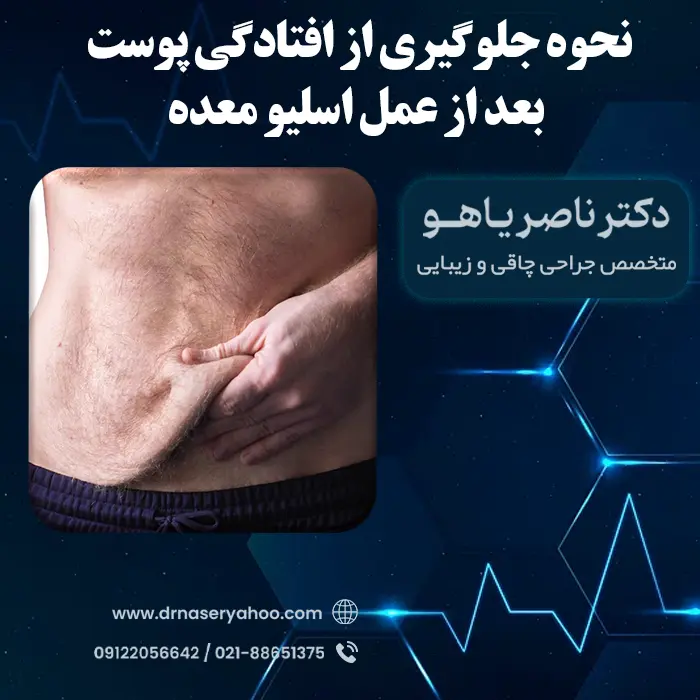 نحوه جلوگیری از افتادگی پوست بعد از عمل اسلیو معده