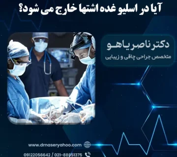 آیا در اسلیو غده اشتها خارج می شود؟