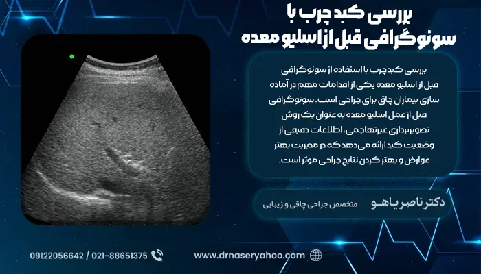 بررسی کبد چرب با سونوگرافی قبل از اسلیو معده