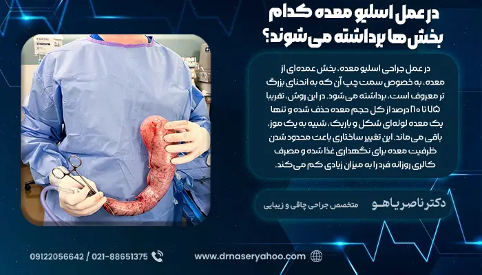در عمل اسلیو معده کدام بخش‌ها برداشته می‌شوند؟