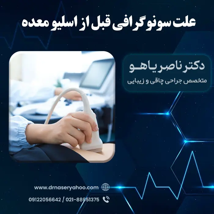 علت انجام سونوگرافی قبل از اسلیو معده