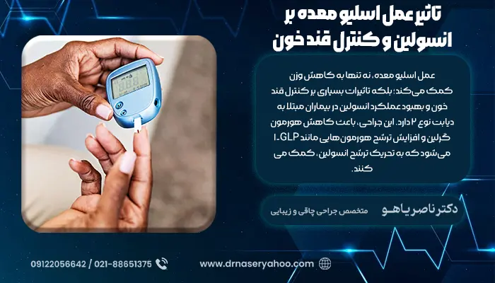 تاثیر عمل اسلیو معده بر انسولین و کنترل قند خون