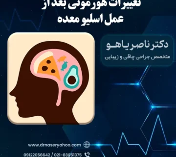 تغییرات هورمونی بعد از عمل اسلیو معده