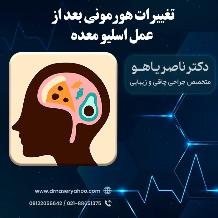تغییرات هورمونی بعد از عمل اسلیو معده