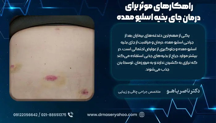 راهکارهای موثر برای درمان جای بخیه اسلیو معده