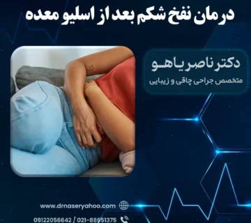 درمان نفخ شکم بعد از اسلیو معده