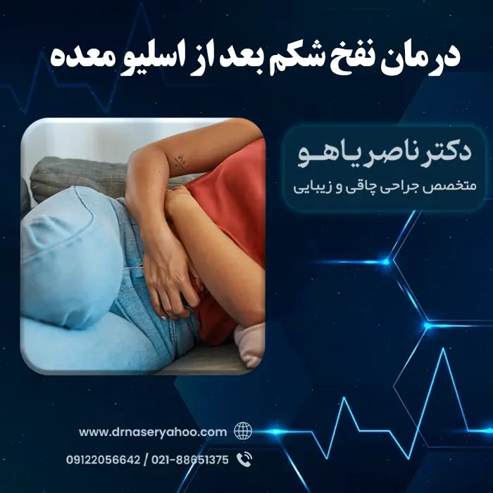 درمان نفخ شکم بعد از اسلیو معده