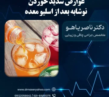 عوارض شدید خوردن نوشابه بعد از اسلیو معده