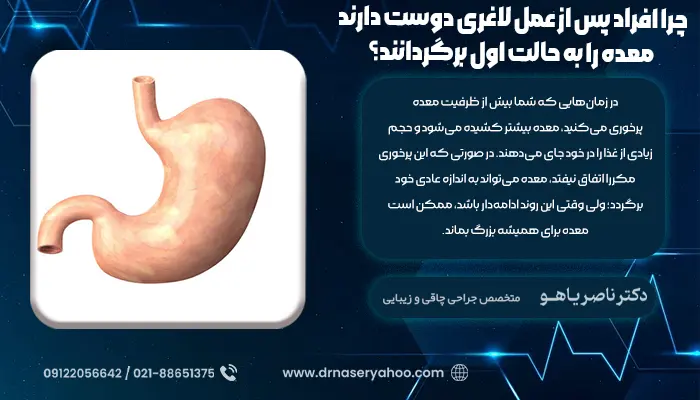 چرا افراد پس از عمل لاغری دوست دارند معده را به حالت اول برگردانند؟