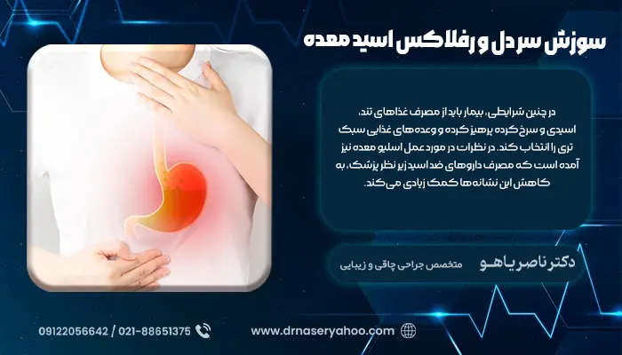 سوزش سر دل و رفلاکس اسید معده